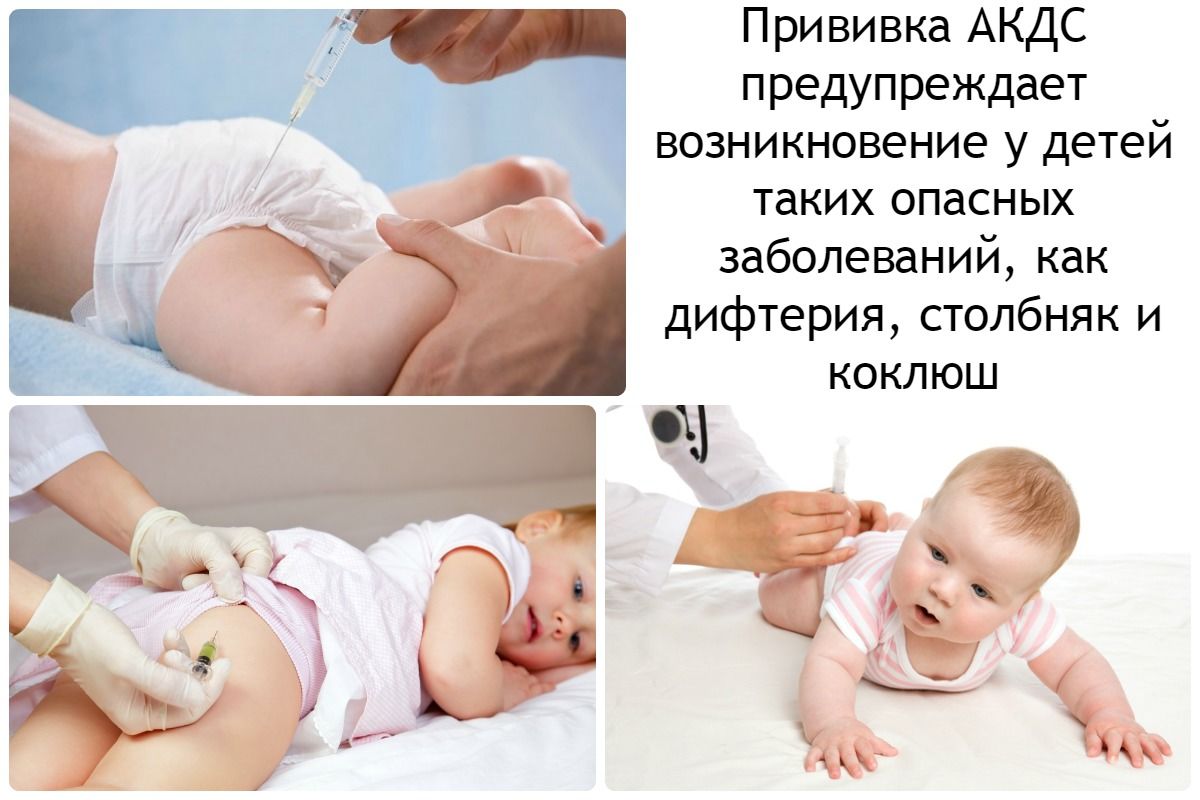 Какие прививки делать ребёнку